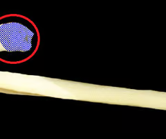 bony expansion carried on a narrow neck