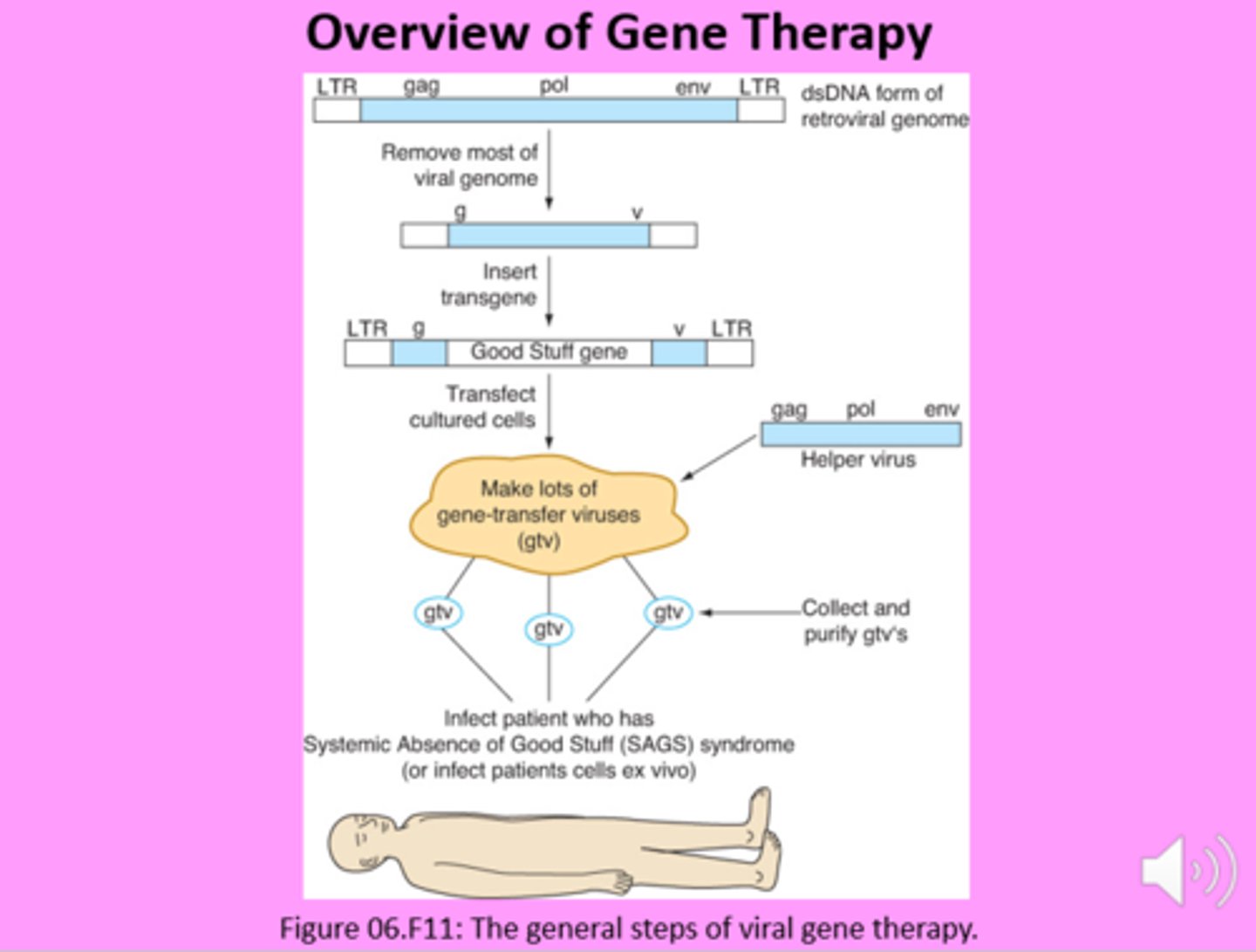<p>1. What you are targeting</p><p>2. If it's going to integrate into the host genome</p>