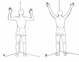 <p>Self-stretching of pectoralis major on bilat shoulders x 15sH x 10 reps 1 set to develop balance in length and strength of shoulder girdle muscles</p>