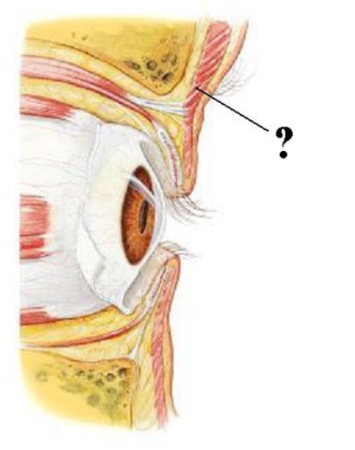 <p>Identify the indicated structure.</p>