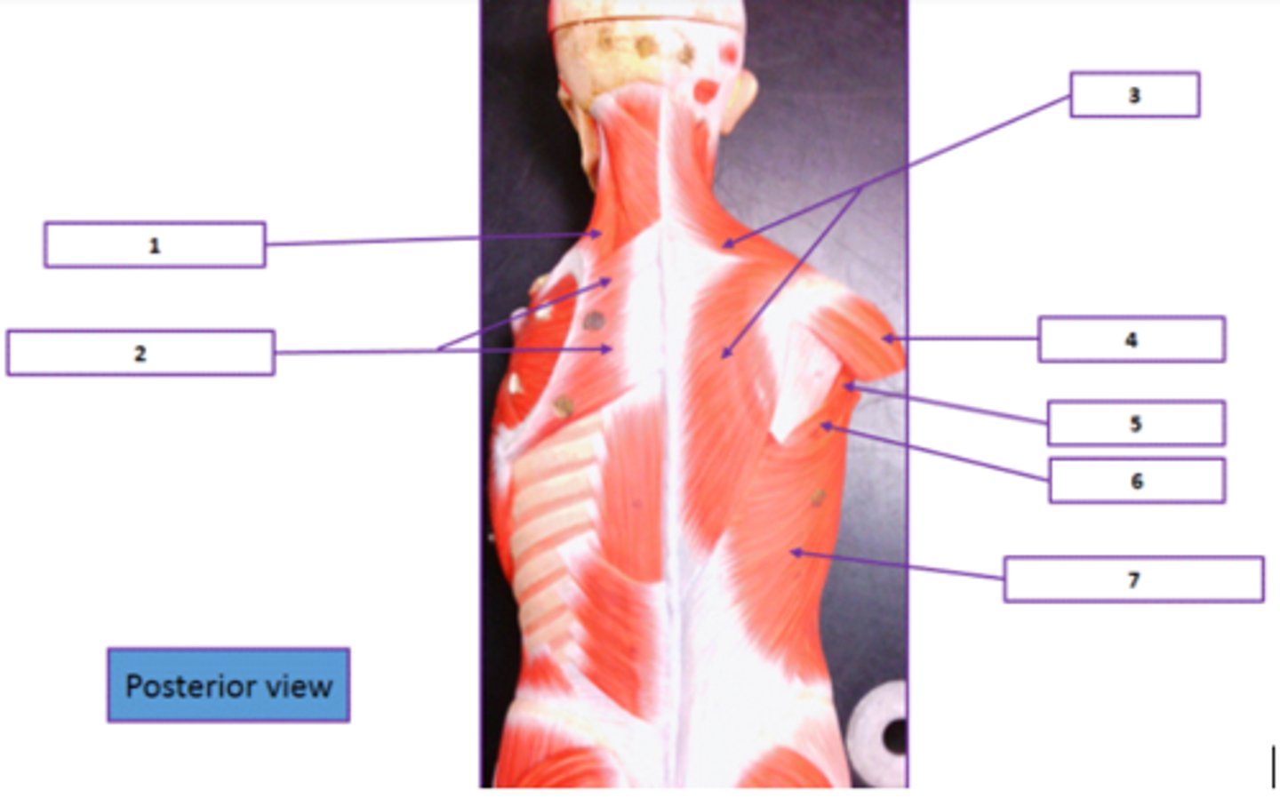 <p>Identify the muscle labeled 5.</p>