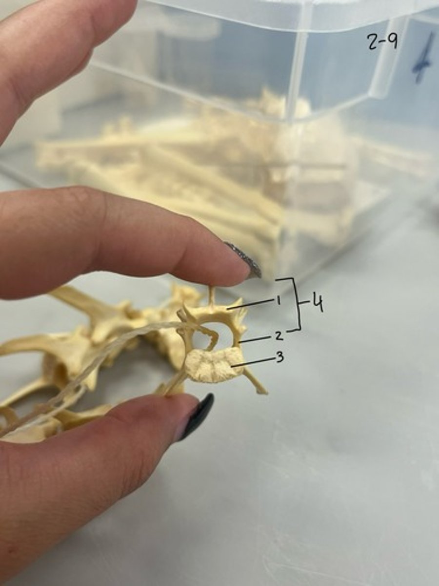 <p>Entire Structure?</p>