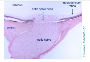 <p>Optic nerve</p>
