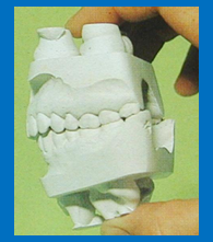<p>How can these <strong>casts</strong> be articulated? (2)</p>