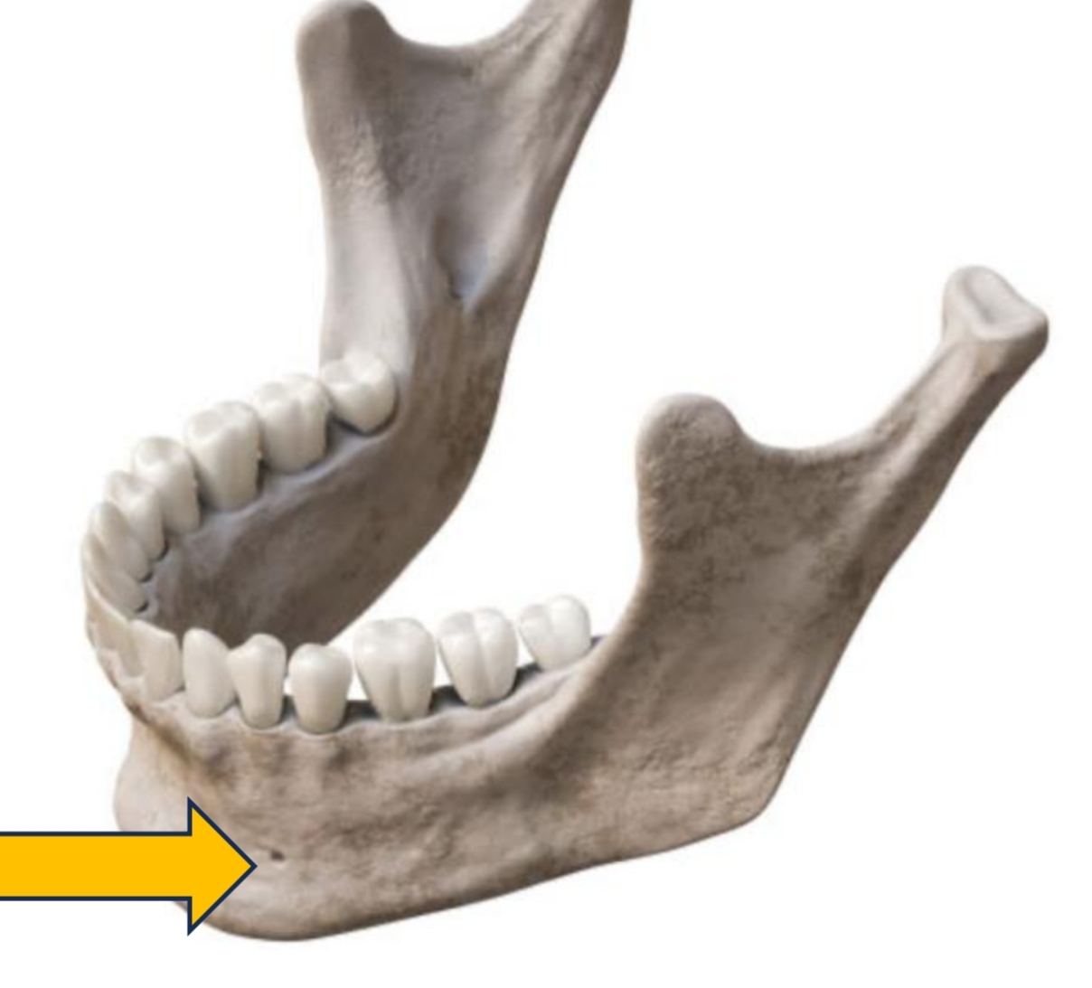 <p>Opening between 1st and 2nd premolars (mental nerve)</p>