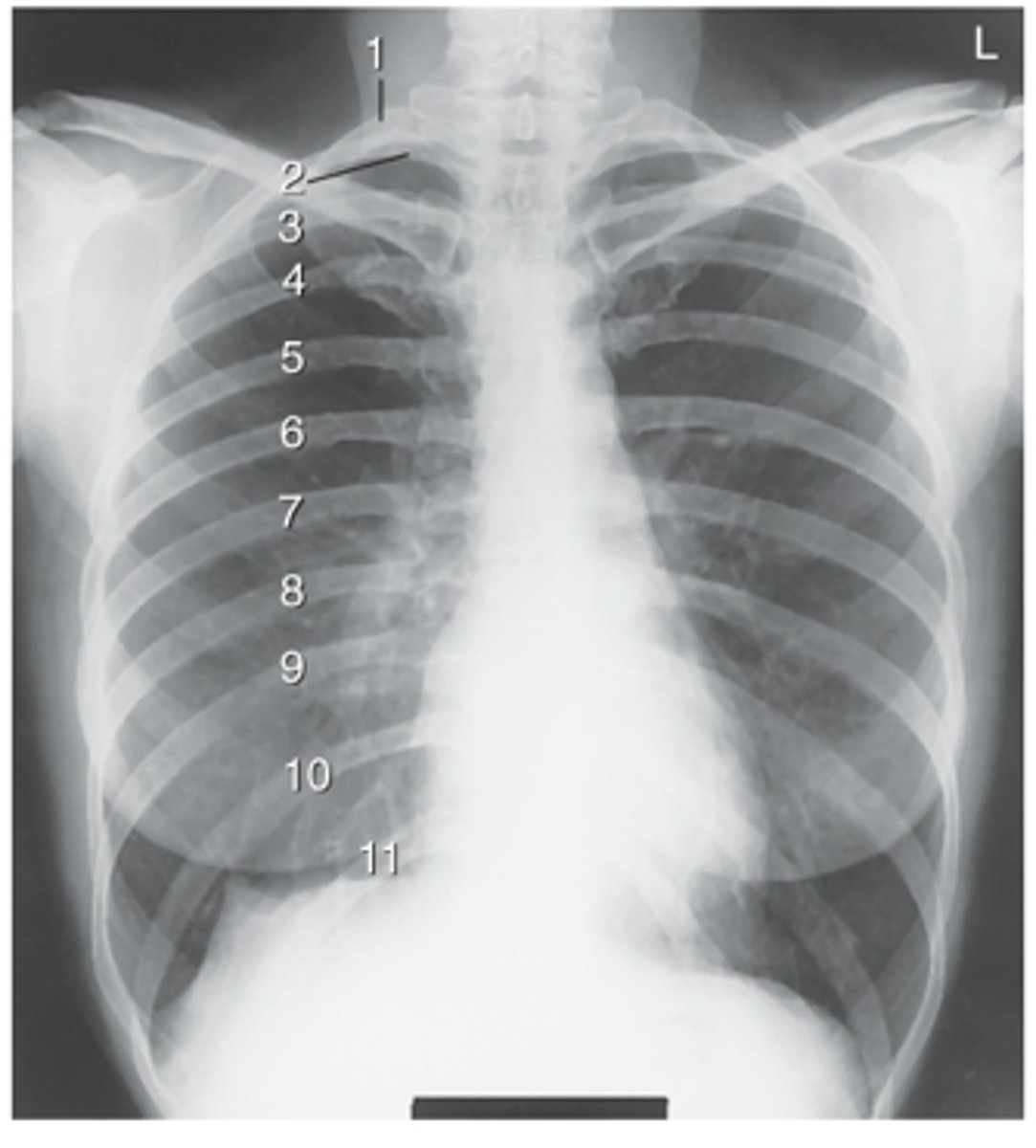 <p>c. 10</p>