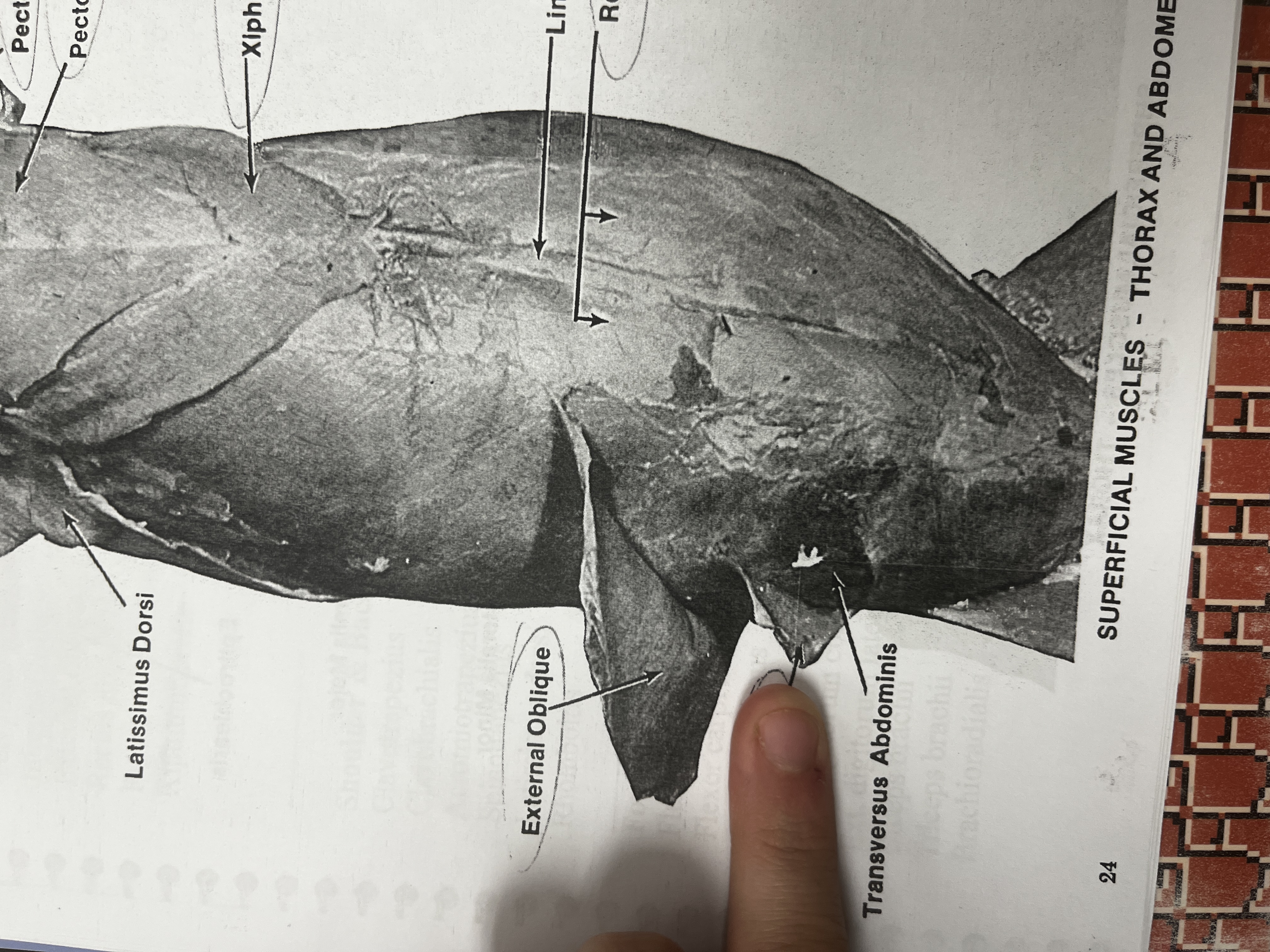 <p>A muscle in the abdominal wall that helps with the rotation and lateral flexion of the trunk.</p>