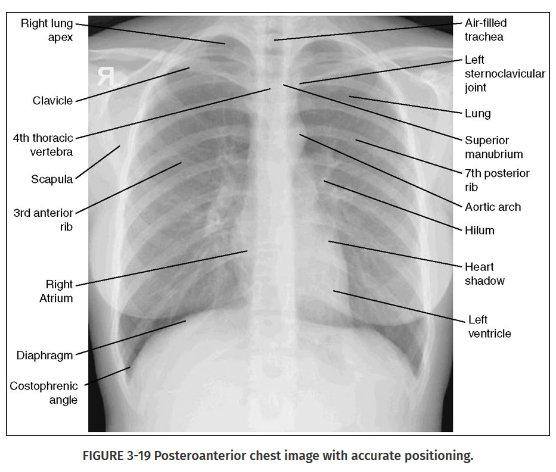<p>Clavicles, scapulae, ribs, apices, costophrenic angles, hilum, and diaphragm.</p>