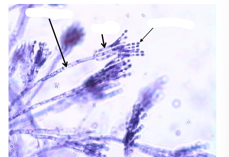<p>Figure 5 (ascomycota); what type of reproduction is this</p>