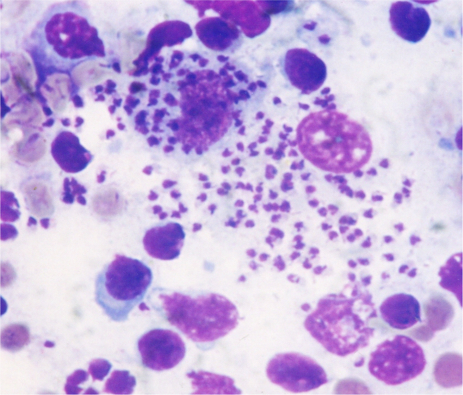 <p>in human</p><p>red papule at bite, warty nodular eruptions</p><p>Mediterranean Sea and east to Russia + China, or West and South to Asia, Central Africa, NE Africa</p>