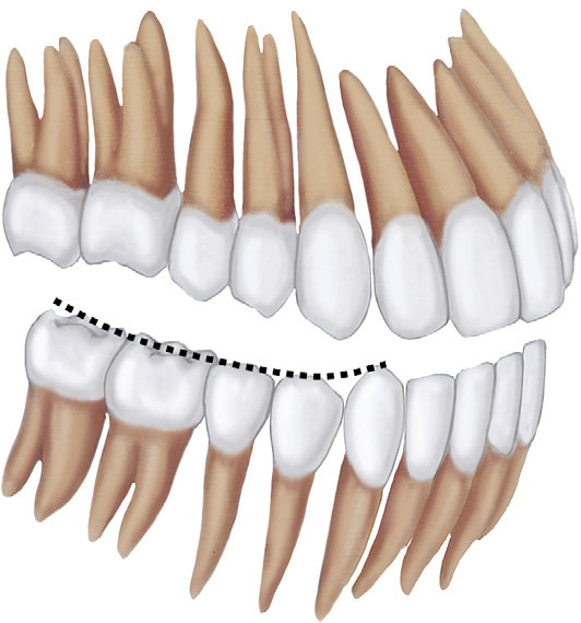 <p>Curvature formed by the maxillary and mandibular arches in occlusion</p>