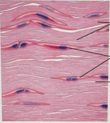 <p>What tissue is this?</p>