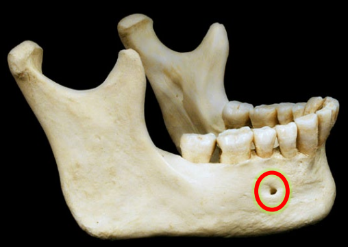 <p>Mental foramen</p>