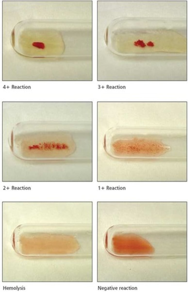 <p>clumping of red blood cells; can occur when incompatible blood types are mixed together due to antibodies binding to antigens</p>