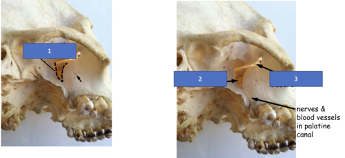 <p>Identify the structure at #2</p>