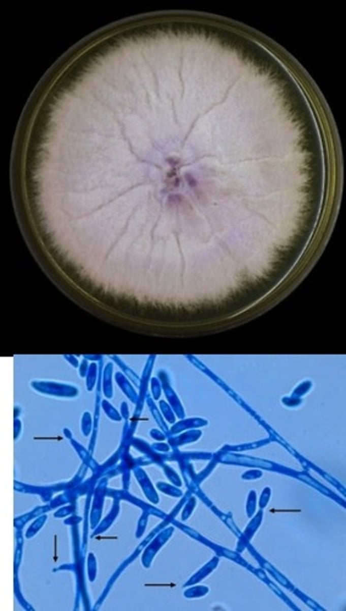 <p>• Violet colonies</p><p>• "Canoe" or "banana"</p><p>microconidia</p>