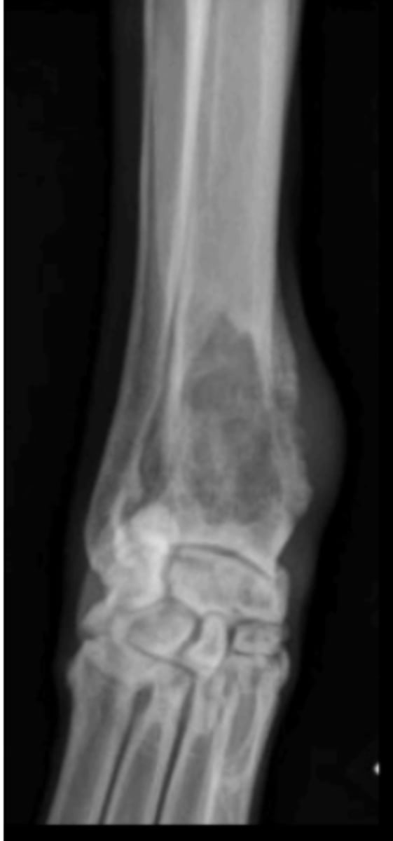 <p>6 y/o dog lame on the limb shown- what kind of tumor is this?</p>