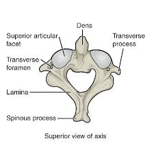 <p>Dens — where we swivel the head “no”, atlas spins on.</p><p></p>
