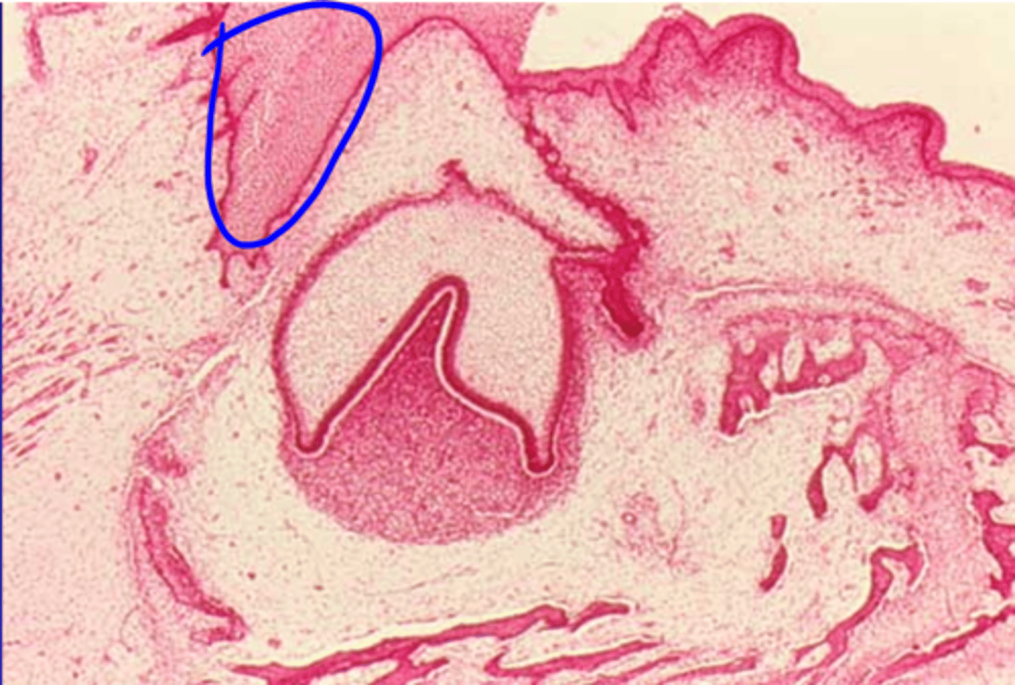 <p>Thickening of oral epithelium in facial or buccal direction from dental lamina</p>