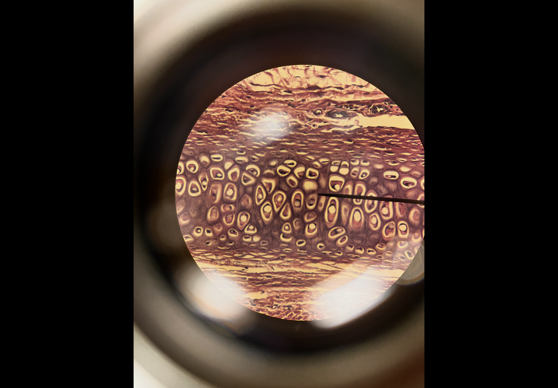 <p>Body location: epiglottis</p>