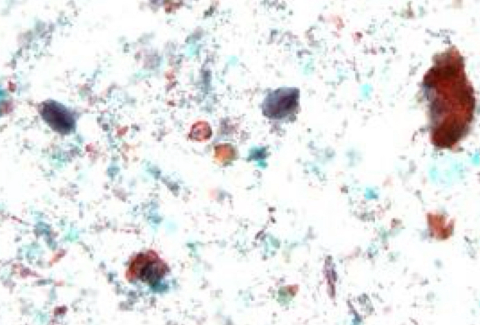 <p>Identify: Protozoa</p>