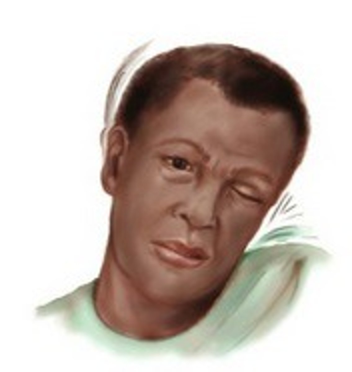 <p>Sudden, brief stereotypical involuntary movements or sounds that occur repeatedly; no - can actually exacerbate them</p>