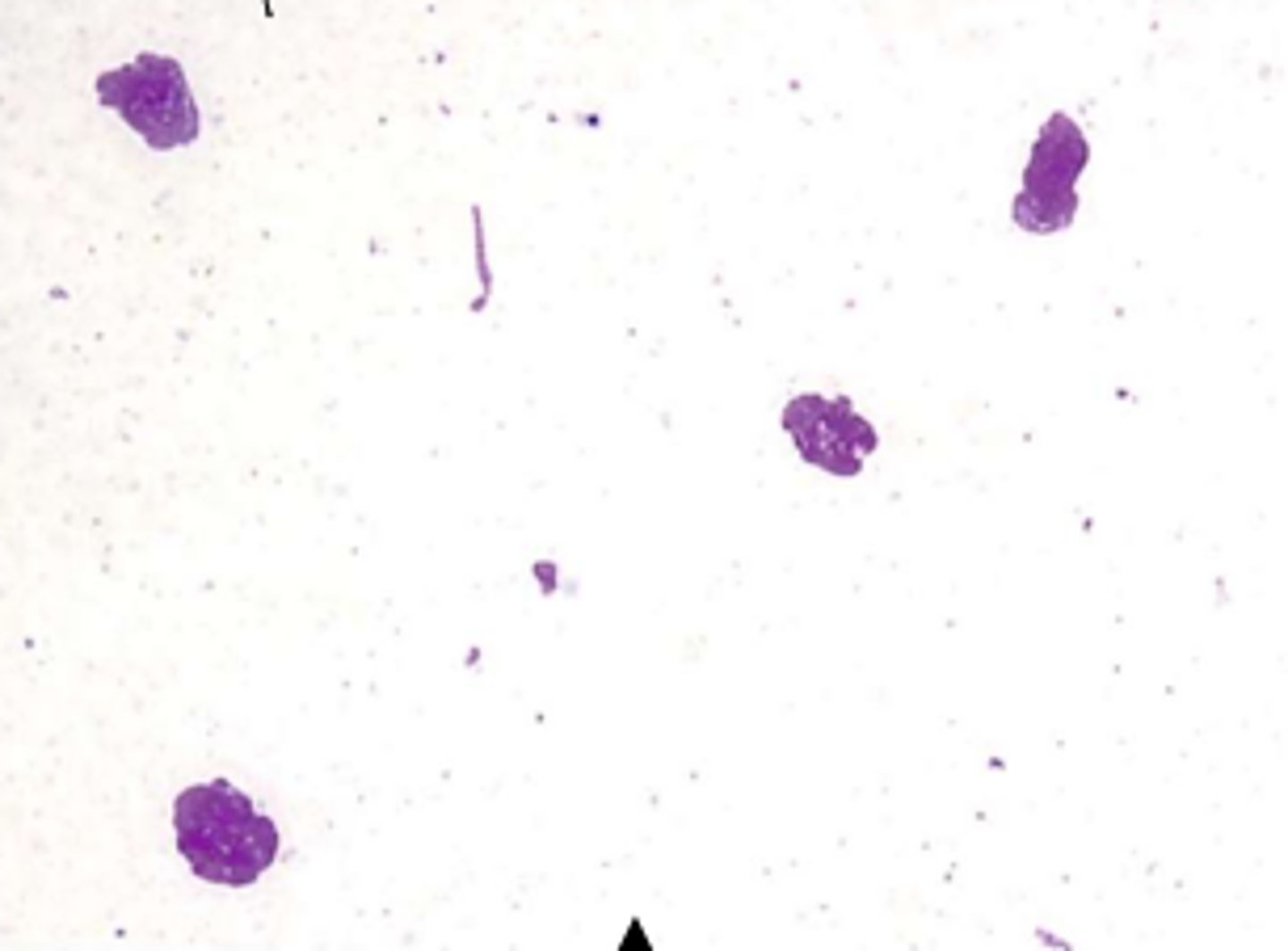 <p>overall low cellularity with many broken cells</p><p>predominant cell type = parabasal cells</p><p>mucus strands often present</p><p>NO red blood cells or neutrophils (unless vaginitis)</p>