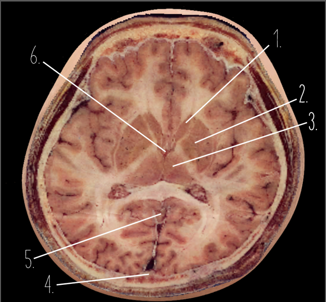 <p>1?</p>