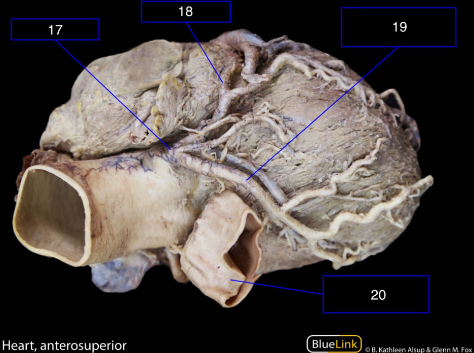 <p>What structures are shown in this video?</p>