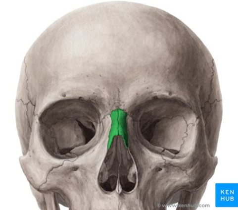 <p>What bone is this?</p>