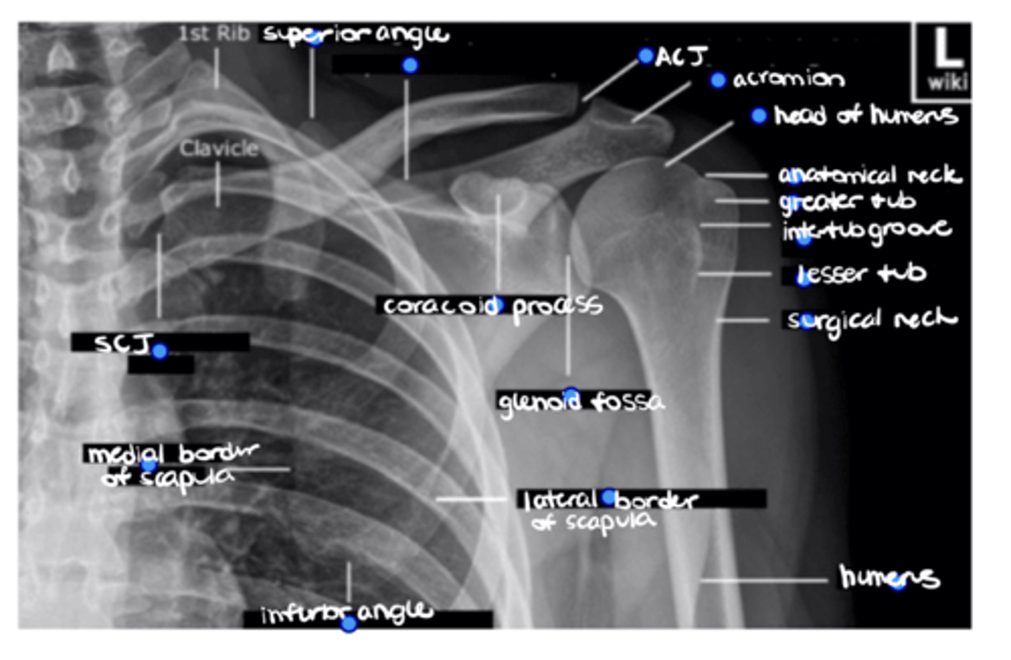 <p>ID the missing structure.</p>