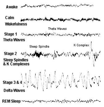 5-10 minutes; presence of theta waves