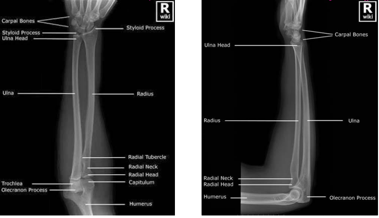 <p><strong>Forearm X-Rays</strong></p><p>-Two views → __ and _______</p><p>-Should include the _____ and _____ joints </p>