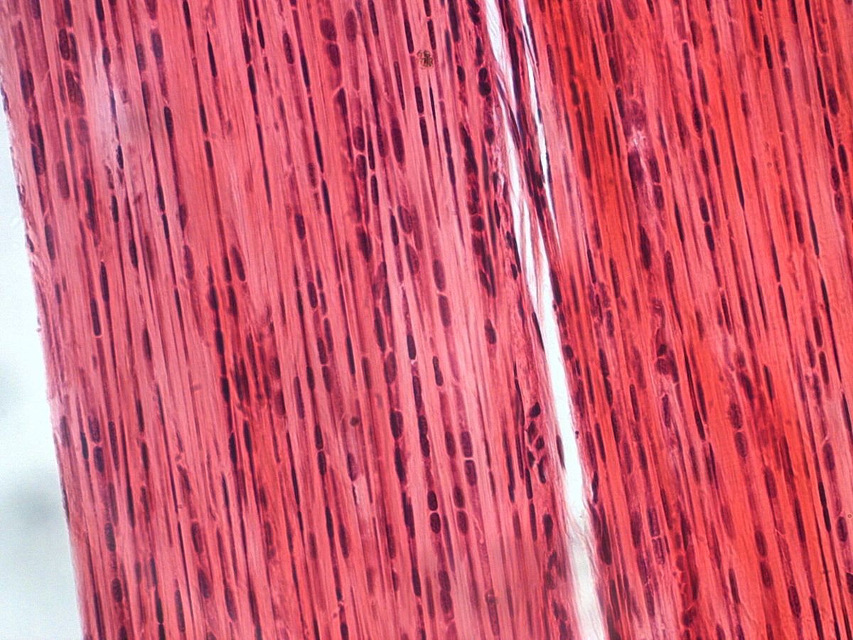<p>Primarily irregularly arranged collagen</p><p class="p1">fibers; some elastic fibers; major cell type is the</p><p class="p1">fibroblast</p><p class="p1">-Able to withstand tension exerted in</p><p class="p1">many directions; provides structural strength.</p><p class="p1">-dermis of skin, fibrous capsule of organs and joints</p>