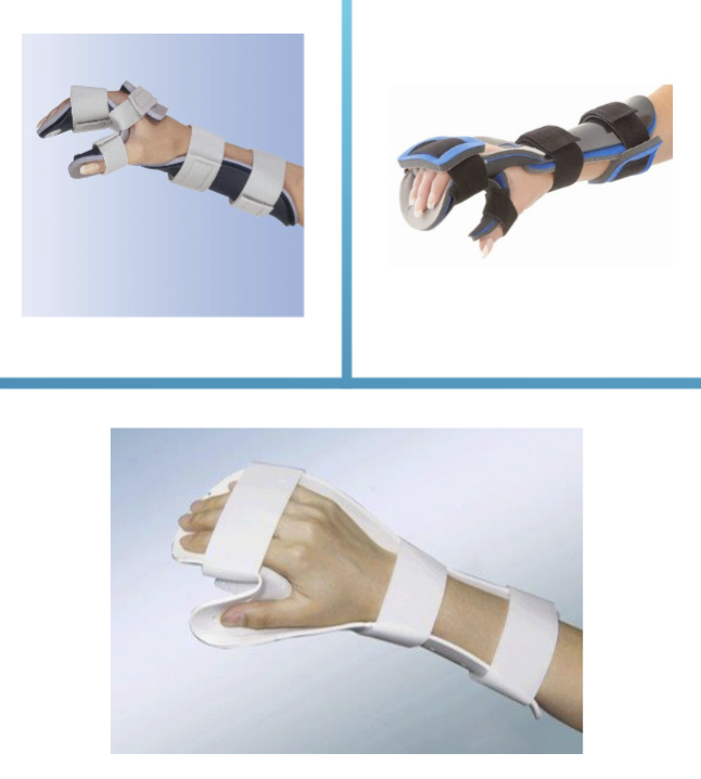 <p>Resting Hand Splint positioning </p>
