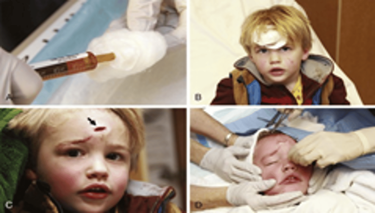 <p>Zone of blanching around wound (d/t Epi)</p>