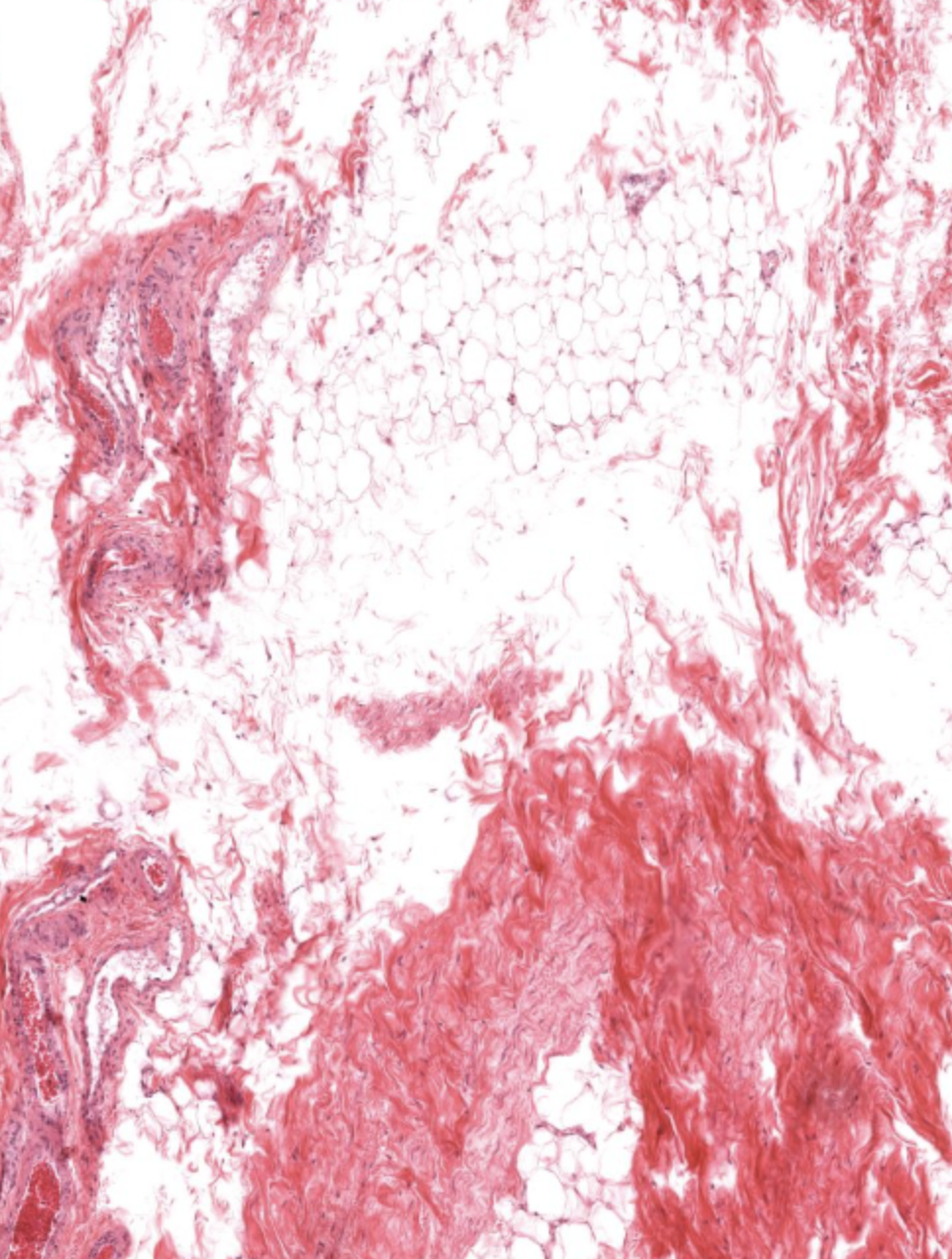 <p>Connective tissue proper that is loose and has a sparse, irregular network of collagen and elastic fibers suspended within a relatively large amount of ground substance.</p>
