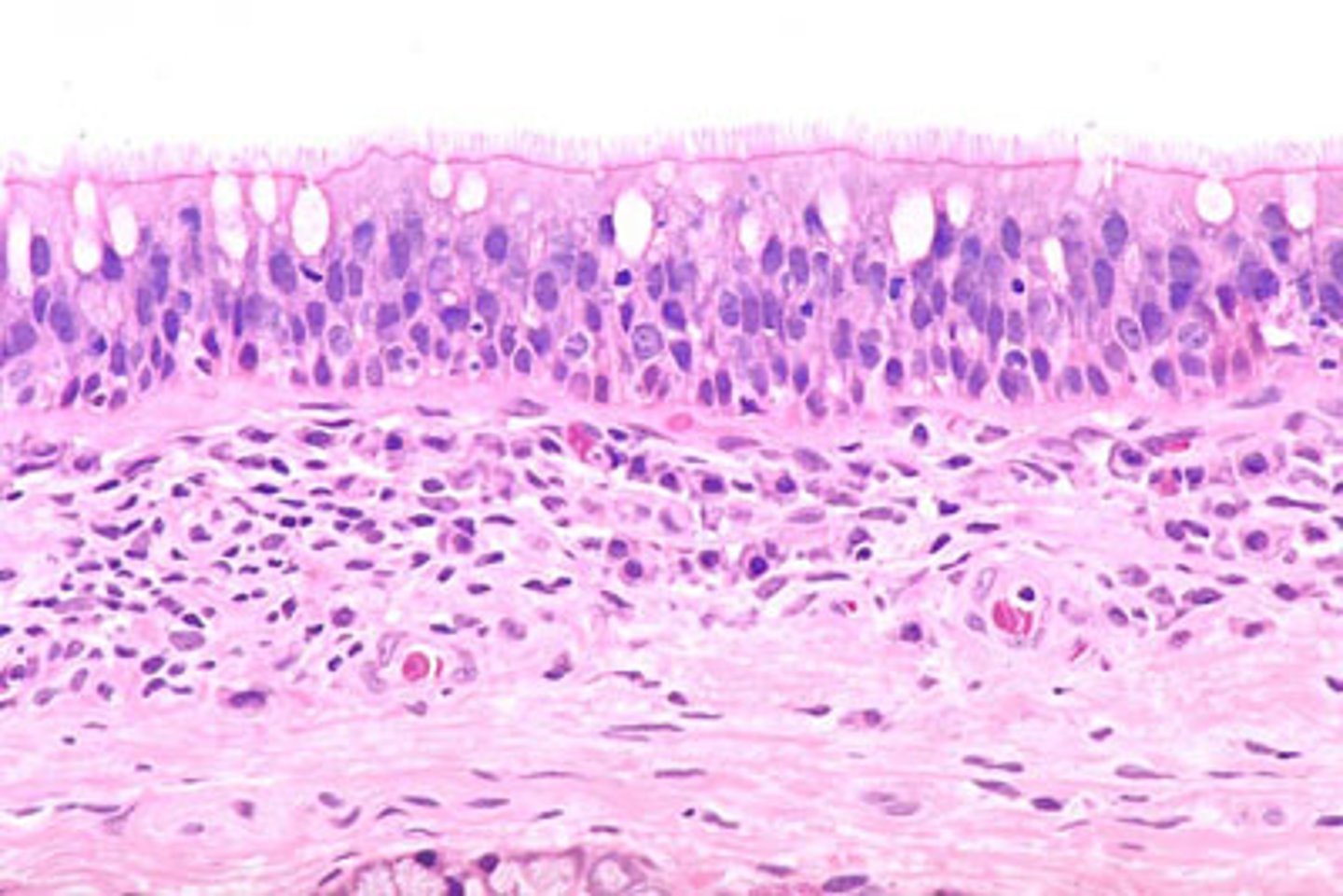 <p>Ciliated, goblet, brush, small granule, and basal cells.</p>