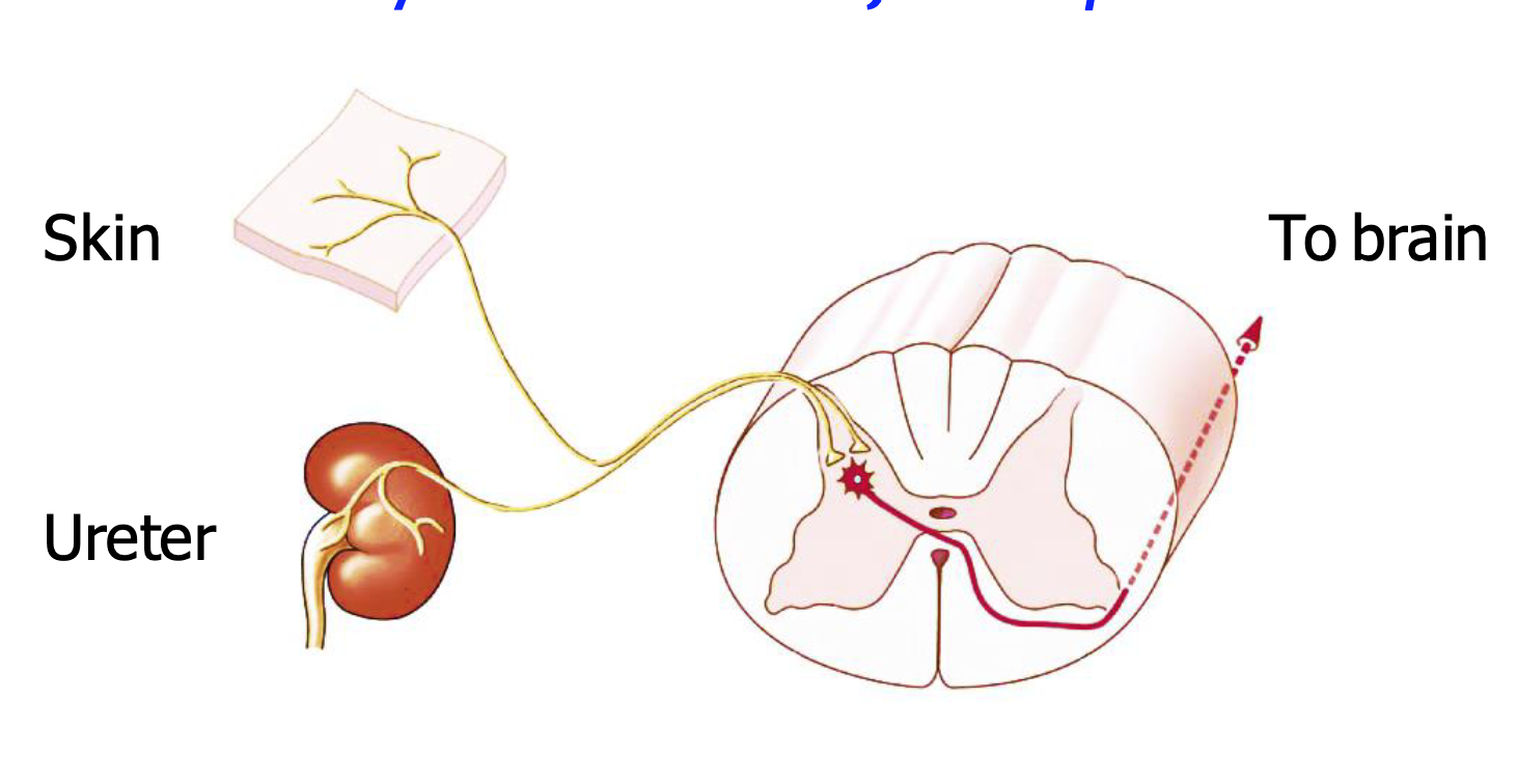 <p>Speaking of referred pain, why it might difficult for the brain to specify where the pain is happening?</p>