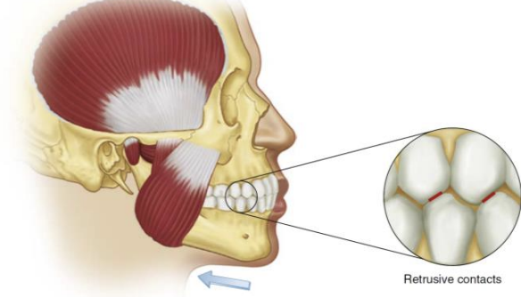 <p>Backwards movement restricted by ligaments (1-2mm)</p>