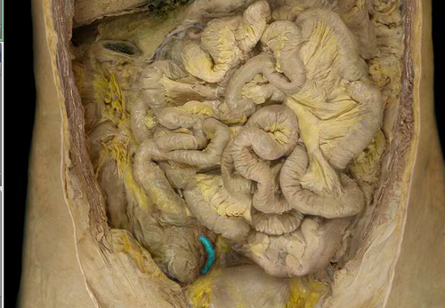 <p>What is this?</p>