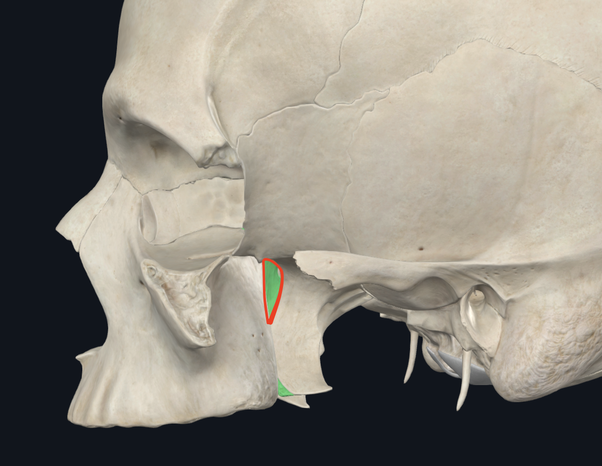 <p>segmento medio, lisa, no articular de la cara externa de la lámina vertical del palatino</p><ul><li><p>Zona no articular de la lámina vertical del palatino</p></li><li><p>Segmento medio de la lámina vertical del palatino</p></li></ul><p></p><p><strong>Pared interna de la hendidura pterigomaxilopalatina</strong></p><p></p>