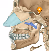 <p>A bony projection located on the sphenoid bone, specifically at the posterior boundary of the sella turcica</p>