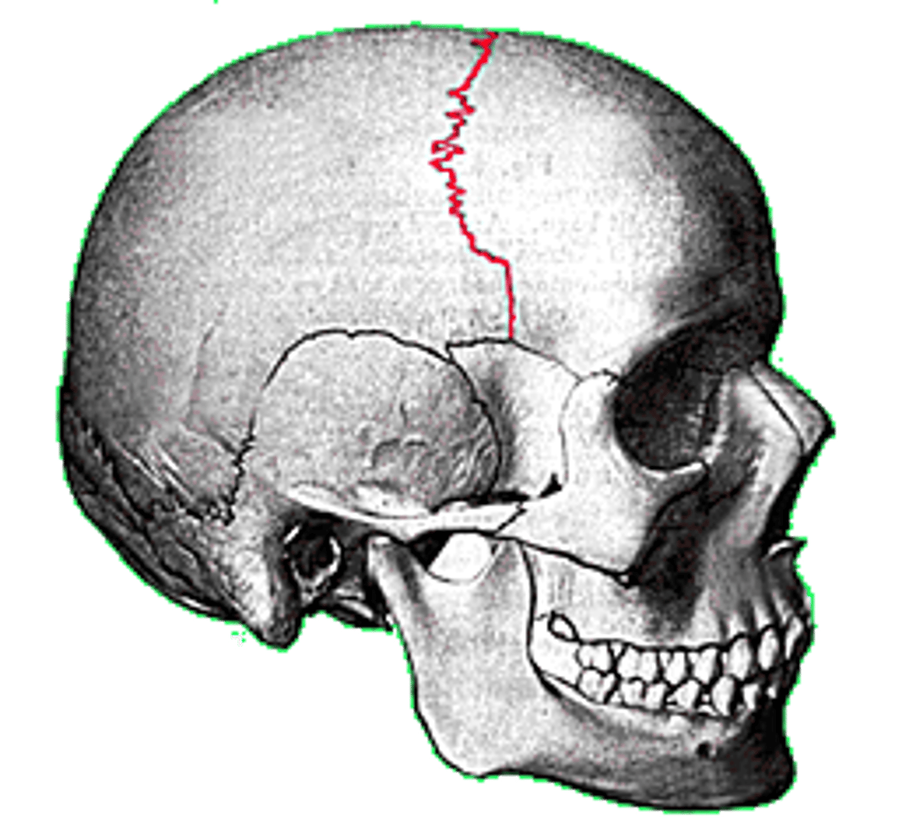 <p>ID suture in red</p>