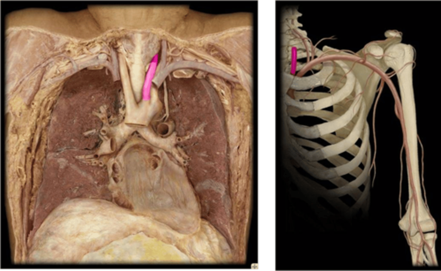 <p>Name this specific vessel (include the side).</p>