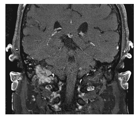 <p>What does the figure show?</p>