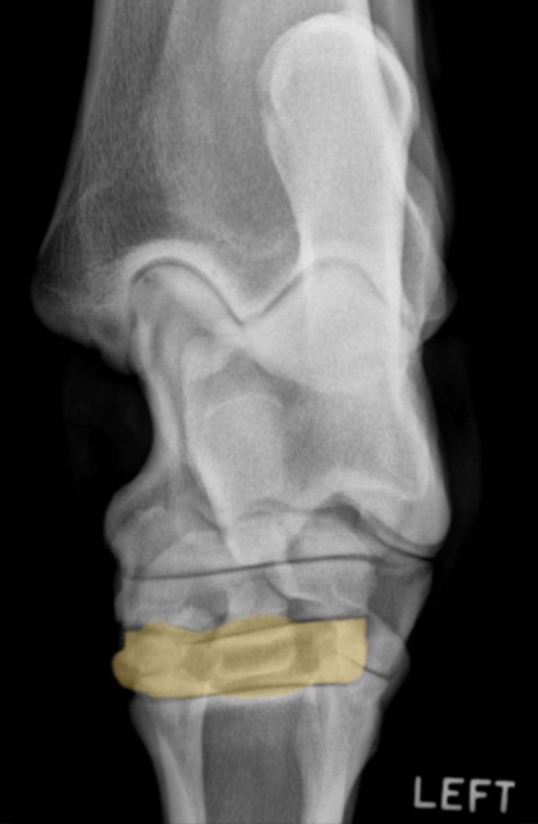 <p>What bone is highlighted here?</p>