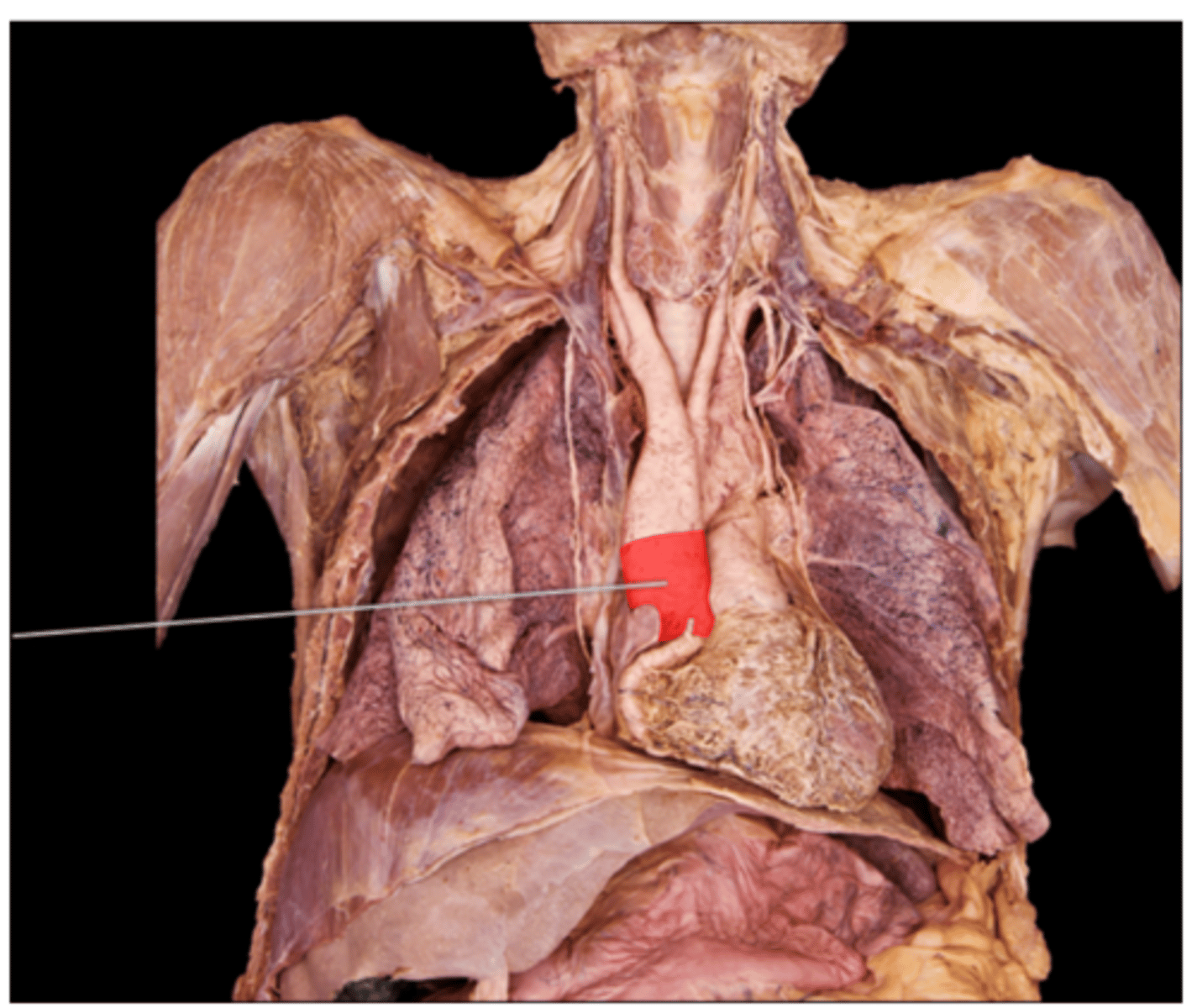 <p>ascending aorta</p>