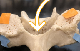 <p><span>Name the structure indicated in this cervical vertebra (big hole)</span></p>