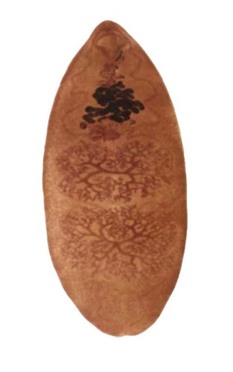 <p>- Type of trematode</p><p>- Acquired from eating metacercariae on aquatic vegetation</p><p>- 10 million cases in Eastern Asia</p>